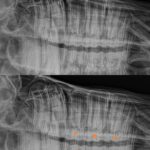 Dental X-rays of a horse's cheek teeth with markers on affected areas