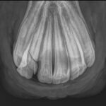 X-ray of a horse's incisor teeth