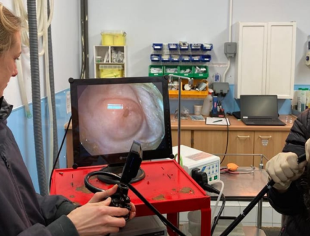 gastroscopy