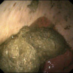 horse eating poo