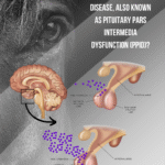cushings disease in horses